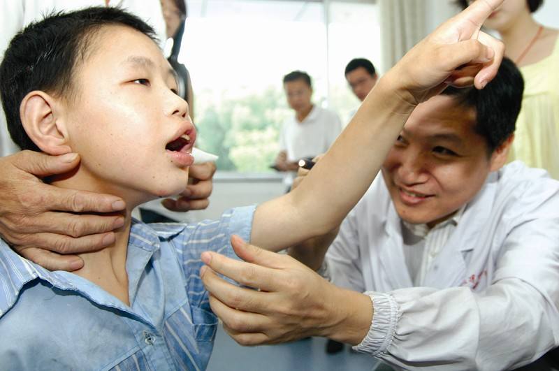 哪些人容易患上癫痫病呢